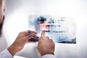 10 X rays 1